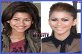 Unveiling The Secrets Of Zendaya's Nose Job: Discoveries And Insights